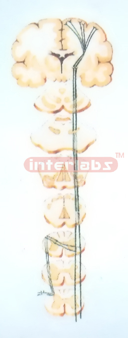 THE PAIN, THALPOTIC AND PSELAPHESIC CONDUCTIVE PATHWAYS MODEL OF THE TRUNK AND LIMBS